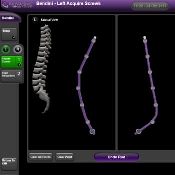 Software Display of Spinal Rod Bending Program
